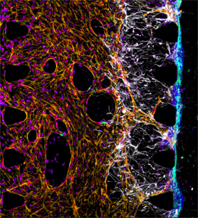 blood-brain-barrier