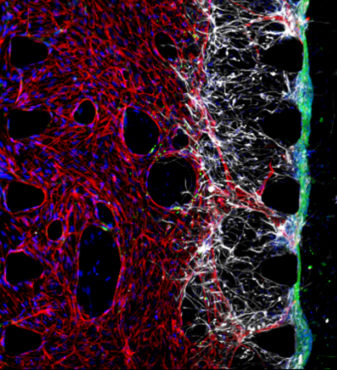 Migration of astrocytes