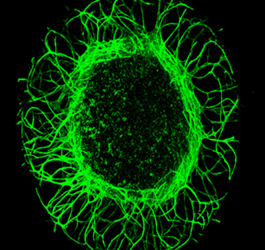 Ocular Angiogenesis