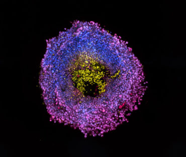 tumor microenvironment