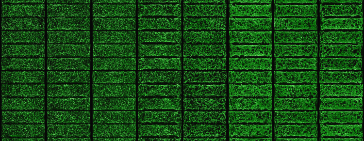 Vasculature Stained with FITC-Lectin