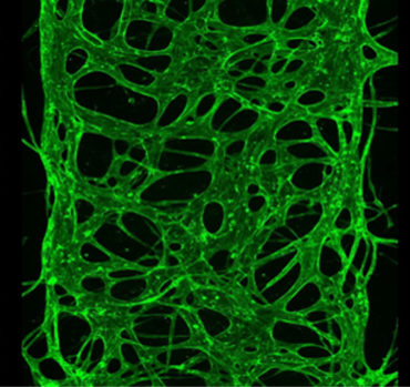 Vasculogenesis induced by mesenchymal